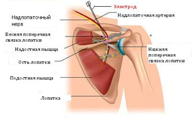 denerve nadlopat